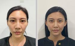 体验前-美莱医学美容医院