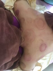 点击看大图 -伊童美家小儿推拿·中式养生(徐汇店)