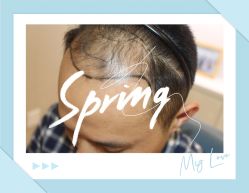 -大麦微针植发全国连锁