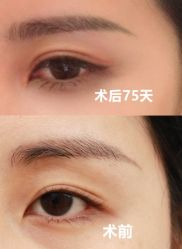 -丰联丽格医疗美容·联合丽格眼整形中心