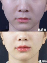 -Yestar重庆艺星医疗美容医院
