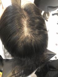 -HAIR CORNER