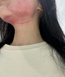 -至简医疗美容·医生集团