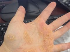 -中国医学科学院皮肤病医院