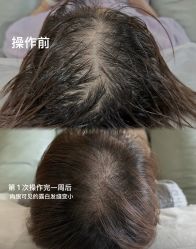 -西施无菌半永久纹绣眉眼影唇轻增发纹发际线