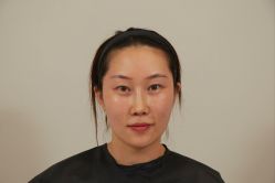 点击看大图 体验前-Dr.U博士医疗美容医院