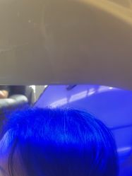 -碧莲盛·不剃发植发