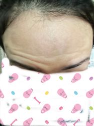 -深圳鹏爱悦心医疗美容医院