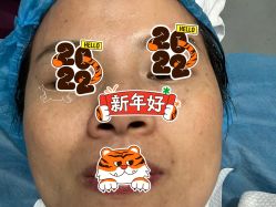 体验后-美瑞莎创美医疗美容