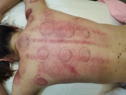 -芳朵美容养生SPA