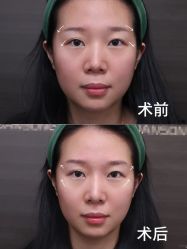 -上海伊莱美医疗美容医院