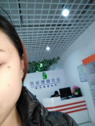 -云贝细胞祛痘痘印