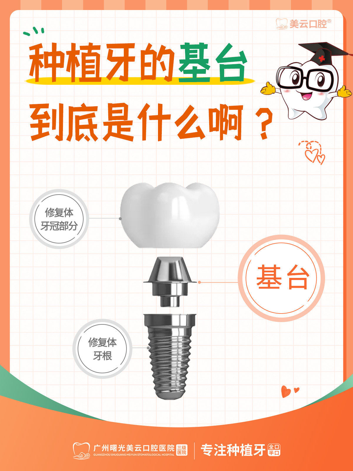 种植牙的基台到底是什么啊?