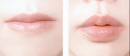 -SKINIST丽铂医疗美容
