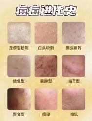 -+MS卓美丝专业祛痘·皮肤管理中心