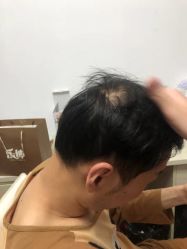 -乐绅男士高端假发定制