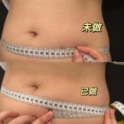 -Fundi张玉珊修身堂·indiba·BTL科技瘦身