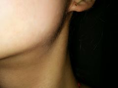 -东南大学附属中大医院(本部)