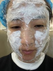 体验前-颜悦医疗美容