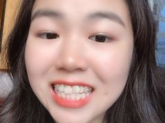 -宁波壹加壹口腔·矫正种植中心