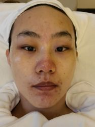 体验前-序言科技美肤中心
