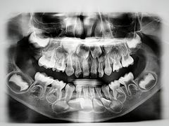 -宁波儿童口腔医院(钱湖院区)