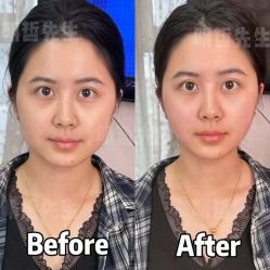 -颜和骨正&明星徒手小颜整骨