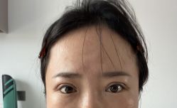 体验后-Dr.U博士医疗美容医院