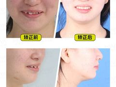 -柏乐口腔(南宁总院)