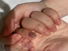 -艾通康缘艾灸.疼痛.睡眠养生馆(凤凰城店)
