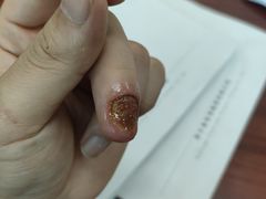 -世龙世家甲沟炎·灰指甲·嵌甲矫正·修脚(武侯区双楠店)