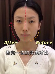 -西安壹加壹医疗美容·西北抗衰旗舰店