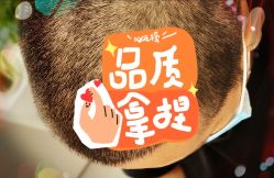 -大麦微针植发全国连锁