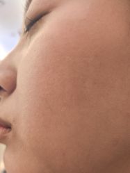 -长沙雅美医疗美容医院
