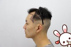 -大麦微针植发丨全国连锁