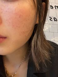 体验后-北京博泽医疗美容门诊部