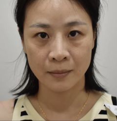 -天津健丽·去眼袋医疗美容机构