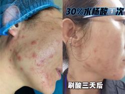 -LUNA皮相美·骨相美高级美感