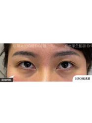 -杭州米兰柏羽医疗美容医院