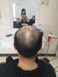 -唐风采假发补发定制