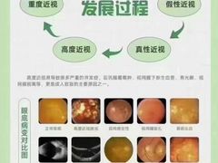 -宝视达眼镜(周口市广场店)