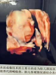 点击看大图 -重庆安琪儿妇产医院-妇幼保健联盟医院