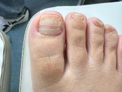 -新甲连锁灰指甲·甲沟炎·鸡眼(黑龙江路店)