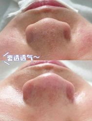 -宥莉·ULLY 痘敏肌•科技皮肤管理中心
