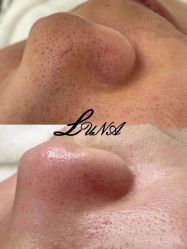 -LUNA皮相美·骨相美高级美感