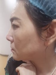 -安徽合肥韩美整形外科医院