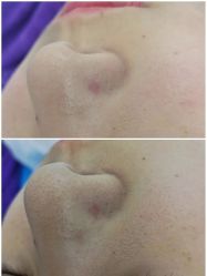-蕾特恩专业祛痘·皮肤管理