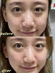 -洁铭新加坡医美