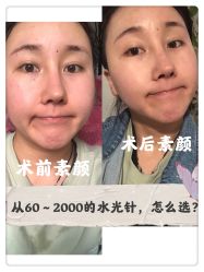 体验前-重庆军科整形美容医院