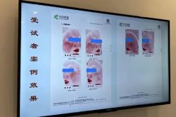 -天其美科学美肤·生发健康管理